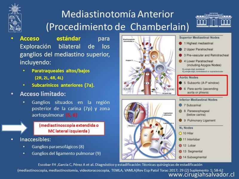 Diapositiva 41 de Accesos quirúrgicos torácicos