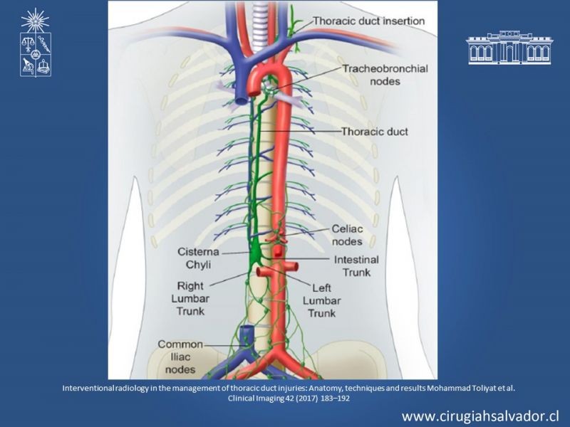Diapositiva 5 de Ascitis quilosa secundaria a cirugía mayor abdominal