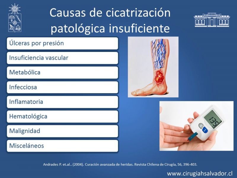 Diapositiva 11 de Curación avanzada de heridas