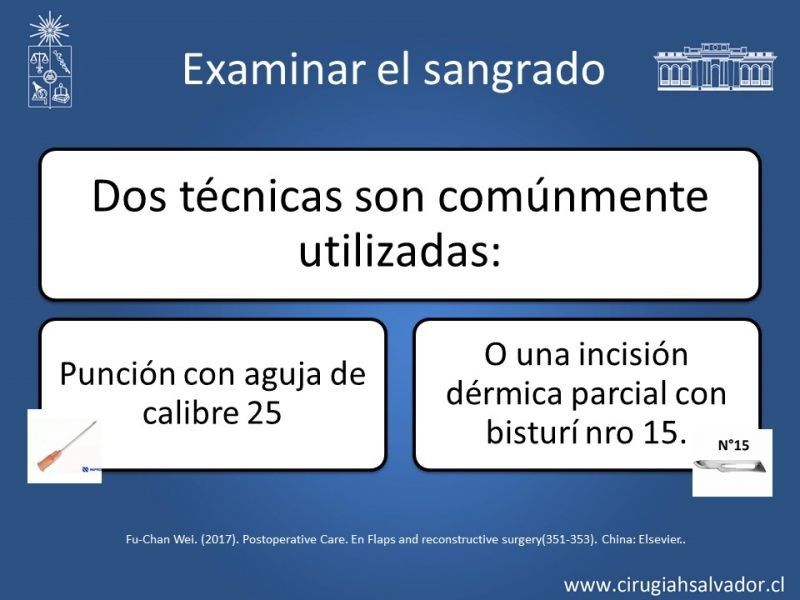 Diapositiva 15 de Monitorización de colgajos