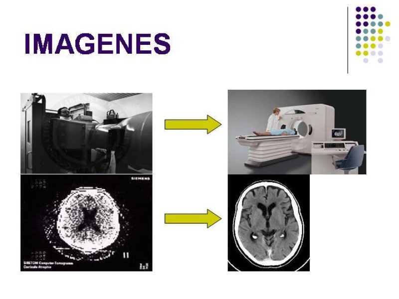 Diapositiva 12 de Imagenología y Apendicitis