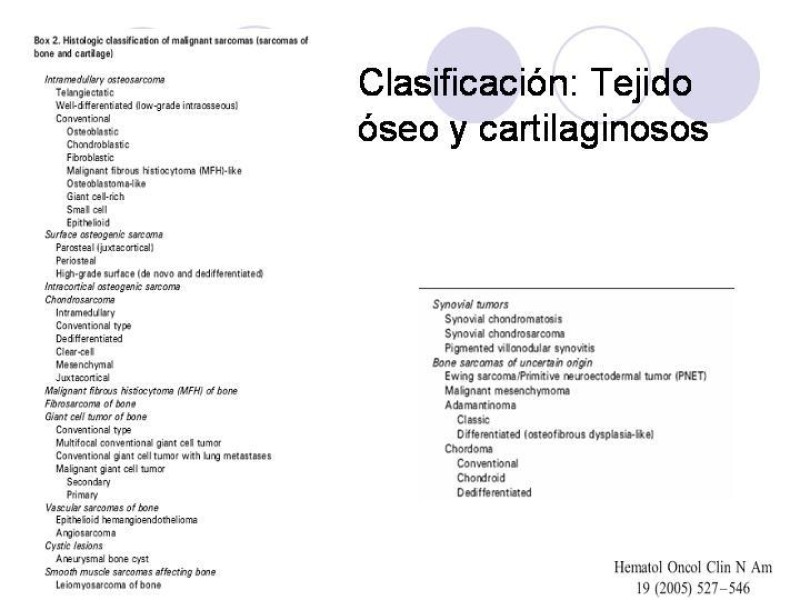 Diapositiva 4 de Sarcomas