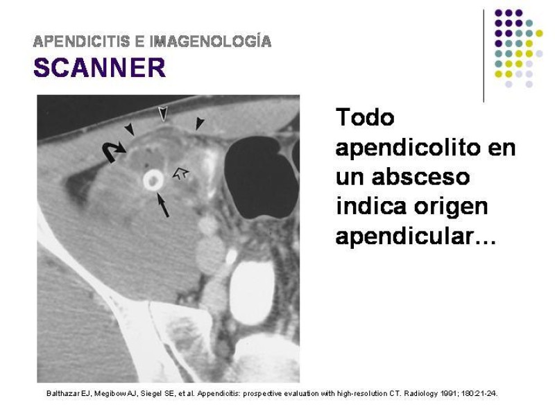 Diapositiva 37 de Imagenología y Apendicitis
