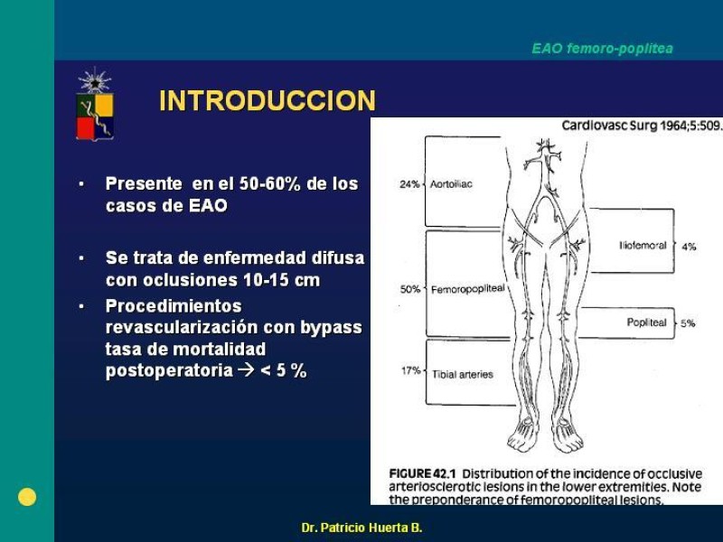 Diapositiva 1 de Tratamiento Quirúrgico de la EAO Fémoro-Poplítea