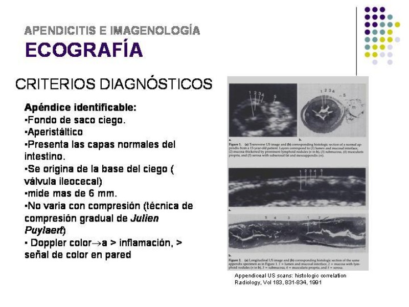 Diapositiva 20 de Imagenología y Apendicitis