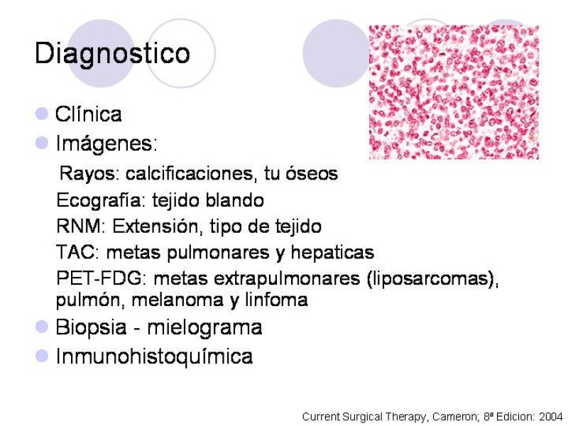 Diapositiva 15 de Sarcomas