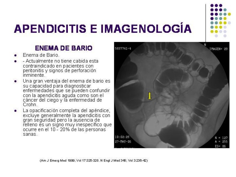 Diapositiva 15 de Imagenología y Apendicitis
