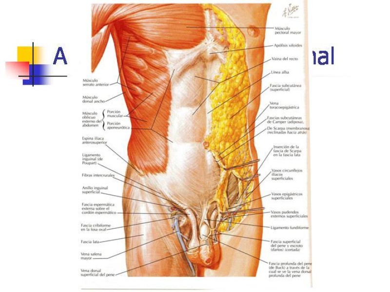 Diapositiva 3 de Hernia Incisional