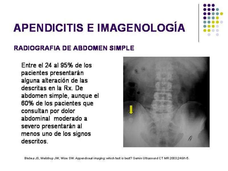 Diapositiva 14 de Imagenología y Apendicitis
