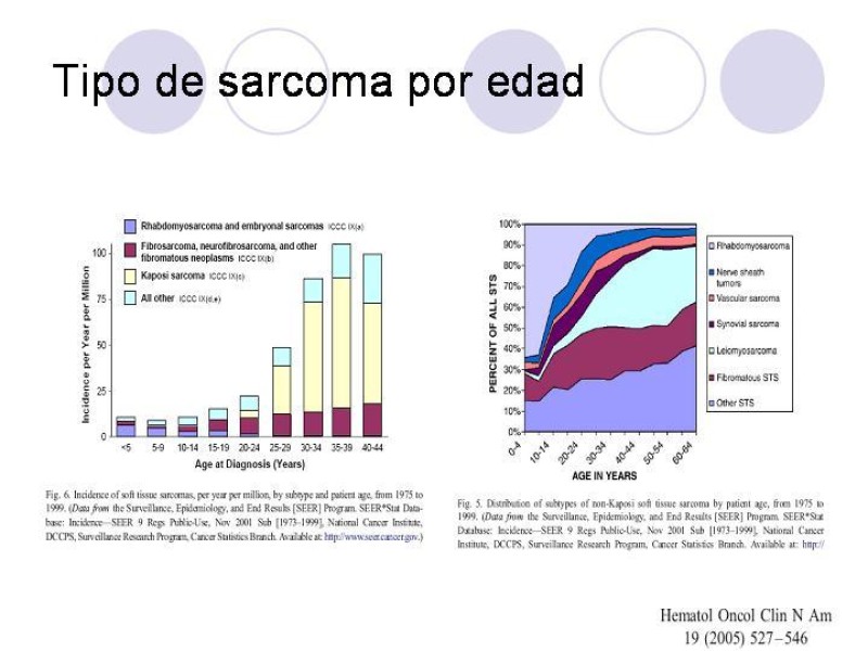 Diapositiva 10 de Sarcomas