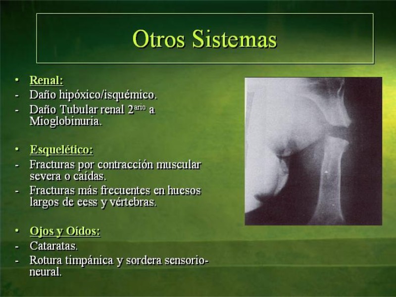 Diapositiva 39 de Lesiones Eléctricas