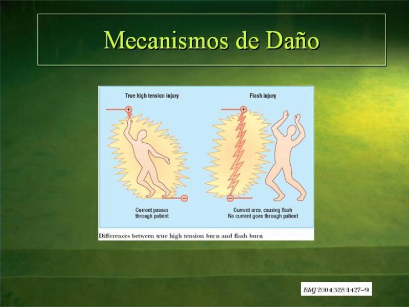 Diapositiva 17 de Lesiones Eléctricas