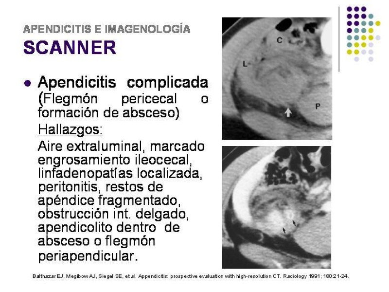 Diapositiva 35 de Imagenología y Apendicitis