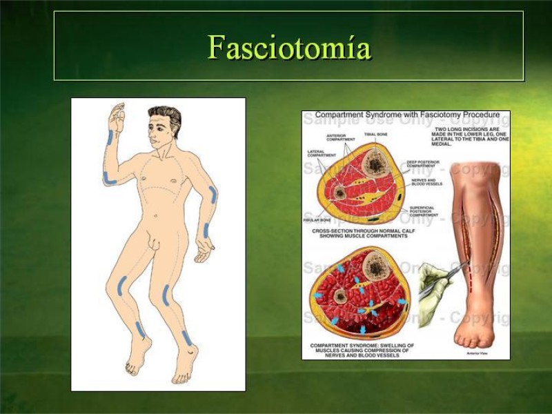 Diapositiva 48 de Lesiones Eléctricas