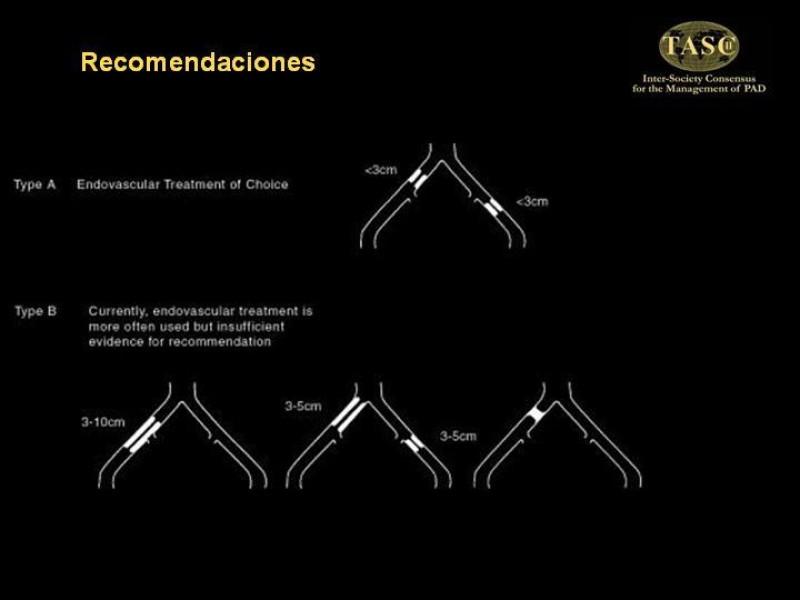 Diapositiva 5 de Tratamiento Quirúrgico de la EAO Aorto- Iliaca