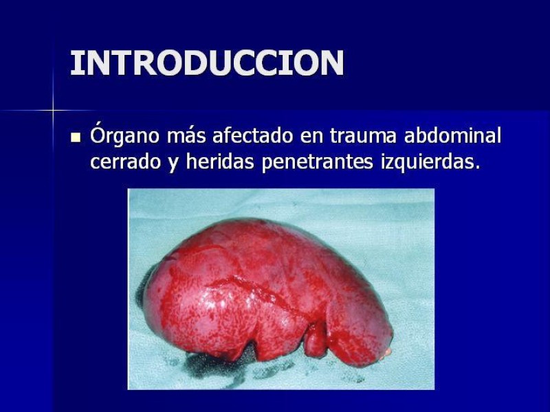 Diapositiva 1 de Trauma Esplenico