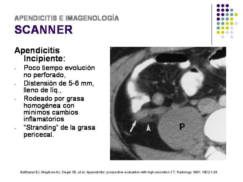 Diapositiva 33 de Imagenología y Apendicitis