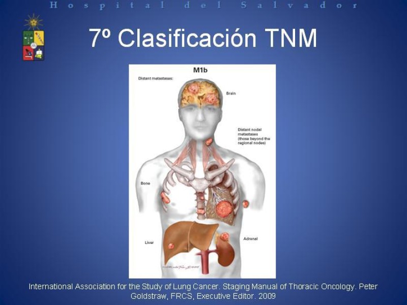 Diapositiva 39 de Cáncer de Pulmón: Diagnóstico y Estadio