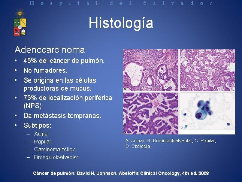 Diapositiva 17 de Cáncer de Pulmón: Diagnóstico y Estadio