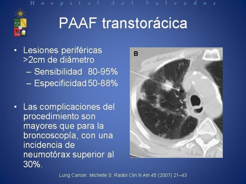 Diapositiva 29 de Cáncer de Pulmón: Diagnóstico y Estadio