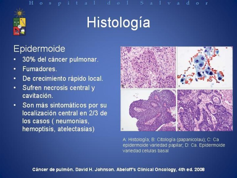 Diapositiva 18 de Cáncer de Pulmón: Diagnóstico y Estadio