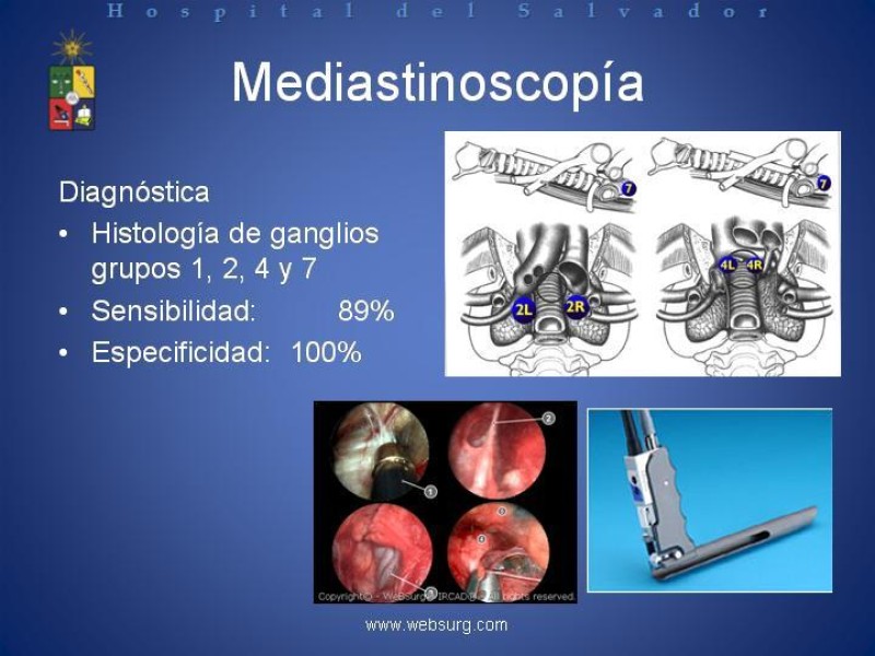 Diapositiva 26 de Cáncer de Pulmón: Diagnóstico y Estadio