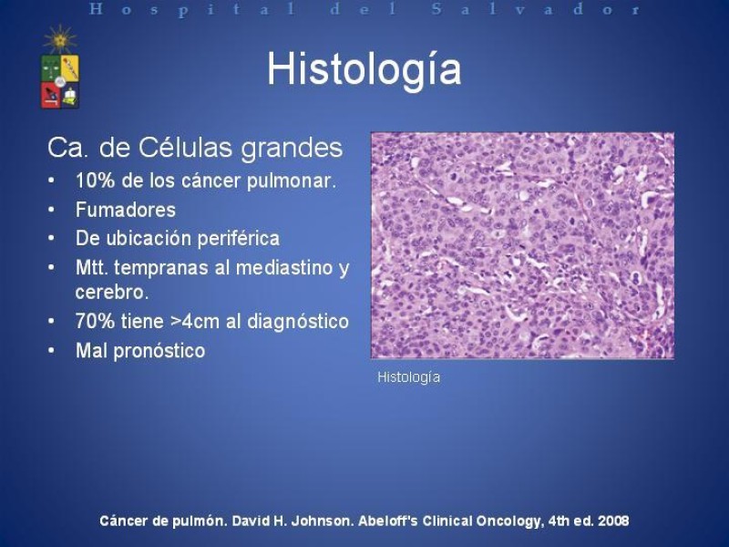 Diapositiva 19 de Cáncer de Pulmón: Diagnóstico y Estadio
