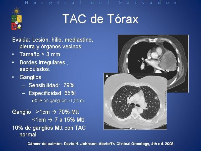 Diapositiva 24 de Cáncer de Pulmón: Diagnóstico y Estadio