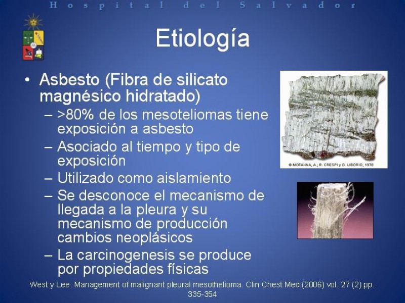 Diapositiva 2 de Mesotelioma Pleural