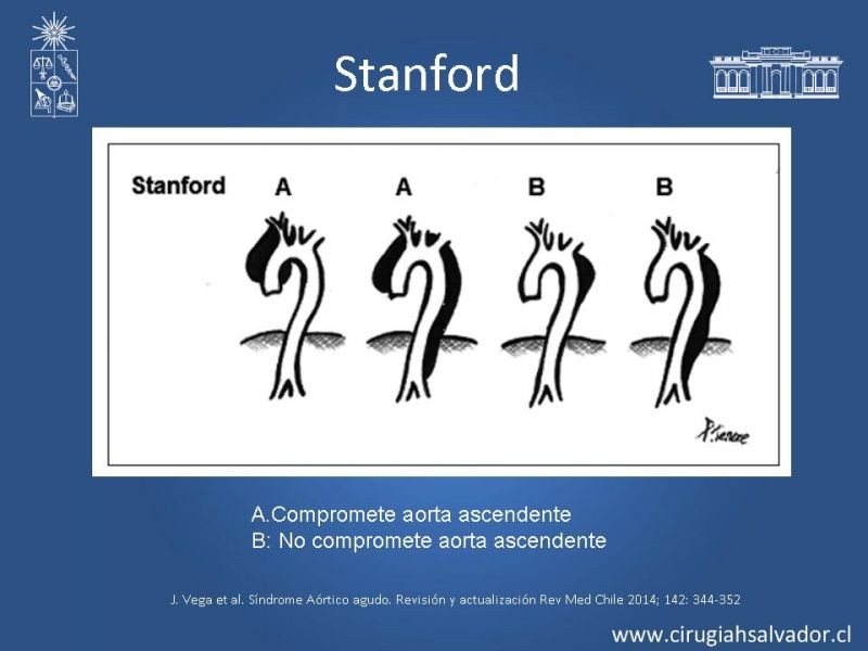 Diapositiva 5 de Manejo Endovascular vs Médico en disección aórtica Tipo B