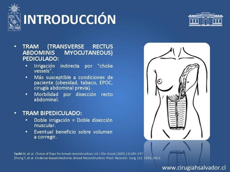 Diapositiva 4 de ¿Qué colgajo utilizar en la reconstrucción mamaria?