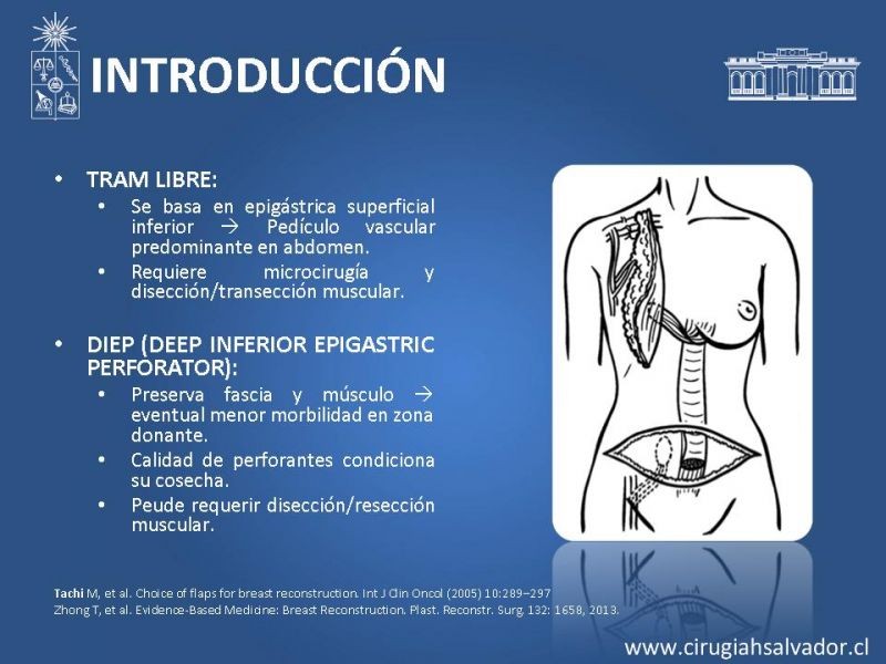 Diapositiva 5 de ¿Qué colgajo utilizar en la reconstrucción mamaria?