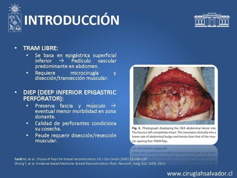 Diapositiva 8 de ¿Qué colgajo utilizar en la reconstrucción mamaria?
