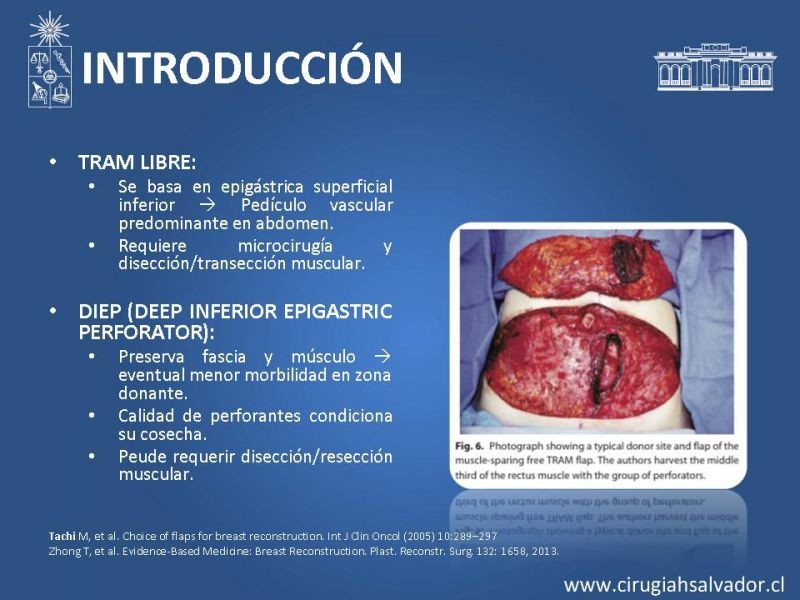 Diapositiva 6 de ¿Qué colgajo utilizar en la reconstrucción mamaria?
