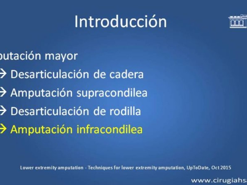 Diapositiva 5 de Amputación infracondilea