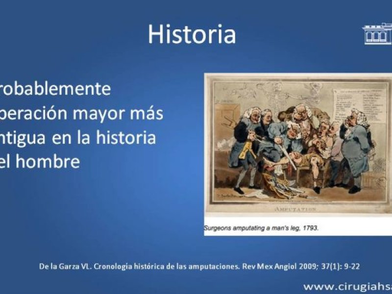 Diapositiva 2 de Amputación infracondilea