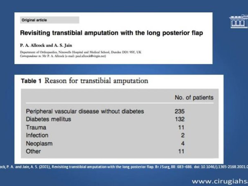 Diapositiva 22 de Amputación infracondilea