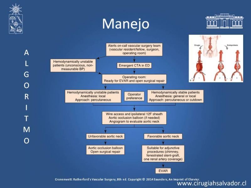 Diapositiva 21 de Aneurisma Aórtico Abdominal Roto