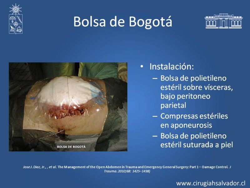Diapositiva 9 de Alternativas de Cobertura en Abdomen Abierto