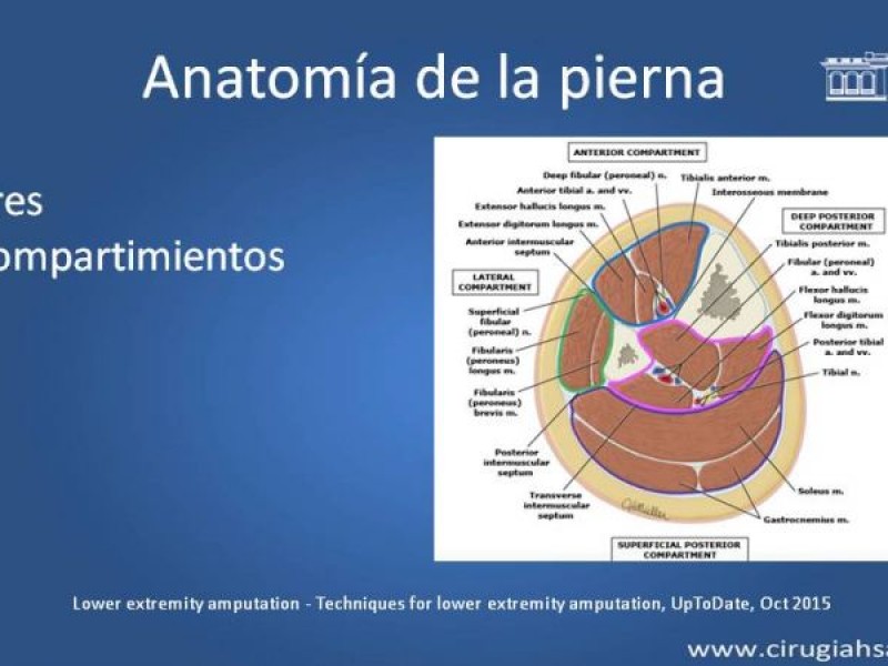 Diapositiva 11 de Amputación infracondilea