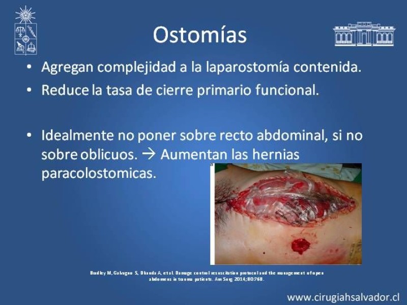 Diapositiva 19 de Open Abdomen (Laparostomía Contenida)