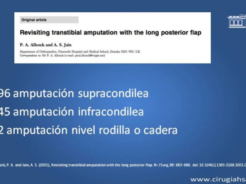 Diapositiva 21 de Amputación infracondilea