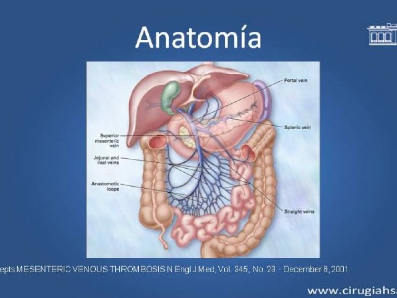 Diapositiva 6 de Trombosis de vena mesentérica