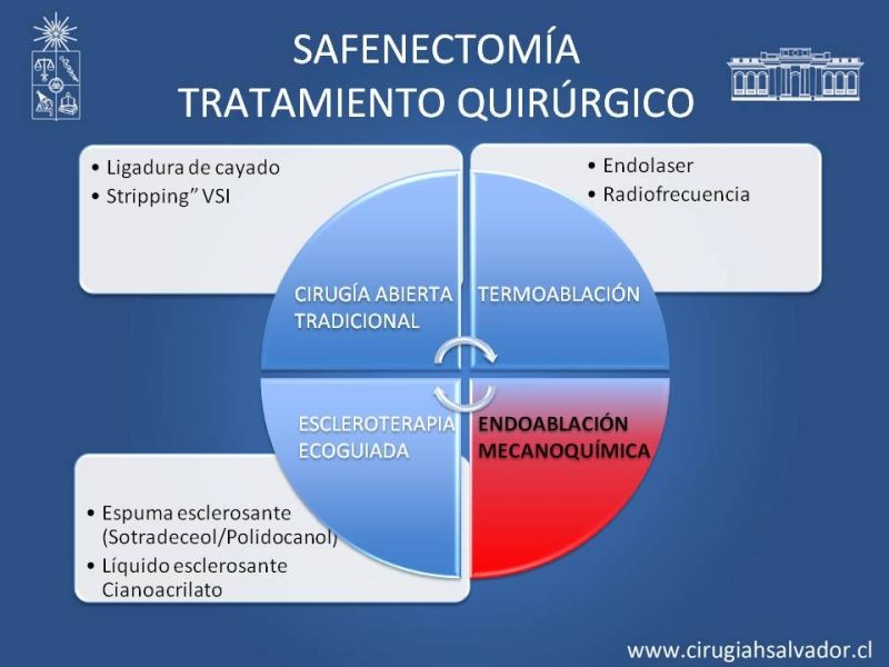 Diapositiva 35 de Safenectomía: técnica y resultados a largo plazo