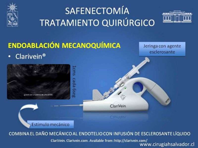 Diapositiva 36 de Safenectomía: técnica y resultados a largo plazo