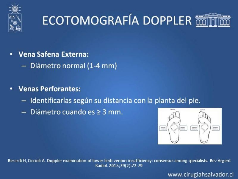 Diapositiva 12 de Safenectomía: técnica y resultados a largo plazo