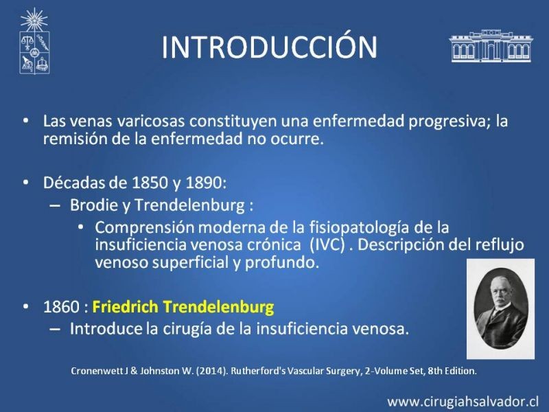 Diapositiva 1 de Safenectomía: técnica y resultados a largo plazo
