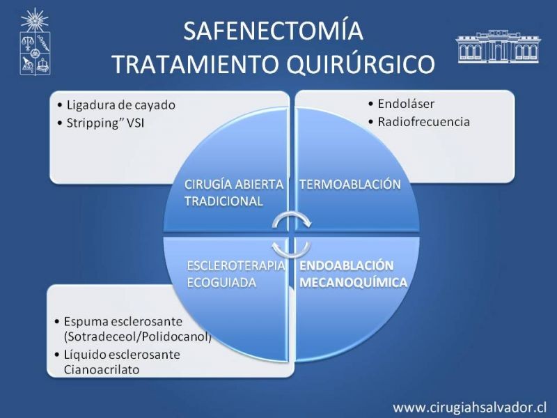 Diapositiva 15 de Safenectomía: técnica y resultados a largo plazo