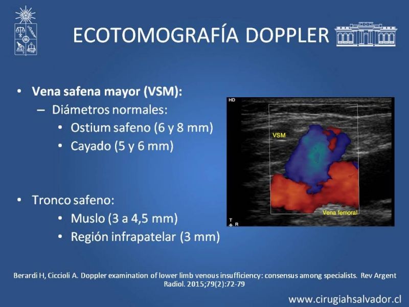 Diapositiva 10 de Safenectomía: técnica y resultados a largo plazo