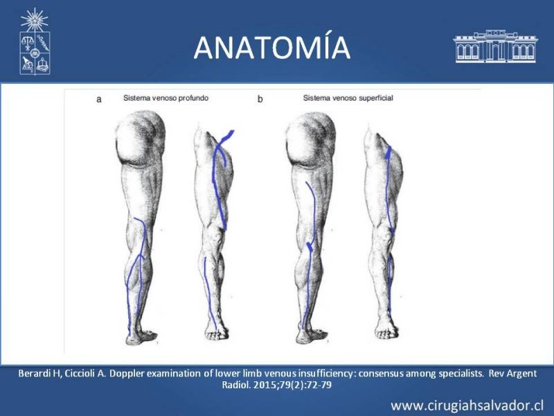 Diapositiva 6 de Safenectomía: técnica y resultados a largo plazo